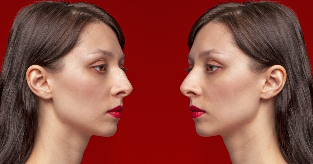 Nose Shape & Personality: What Face Reading Sees in Your Nose